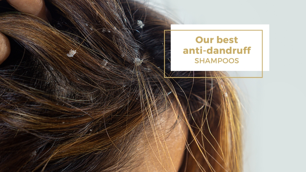 women head with hair full of dandruff